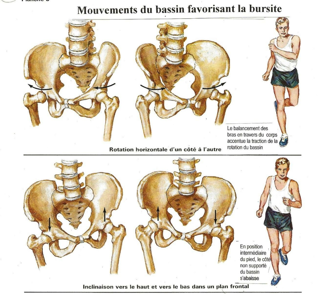 tendinite moyen fessier - bursite