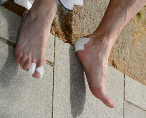 Focus sur des pieds souffrants d'ampoules au niveau du talon et des orteils. Des pansements blancs sont présents à ces endroits.