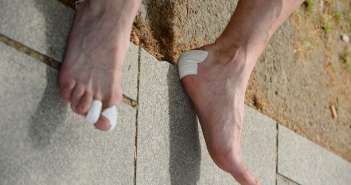 Focus sur des pieds souffrants d'ampoules au niveau du talon et des orteils. Des pansements blancs sont présents à ces endroits.
