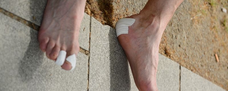 Focus sur des pieds souffrants d'ampoules au niveau du talon et des orteils. Des pansements blancs sont présents à ces endroits.